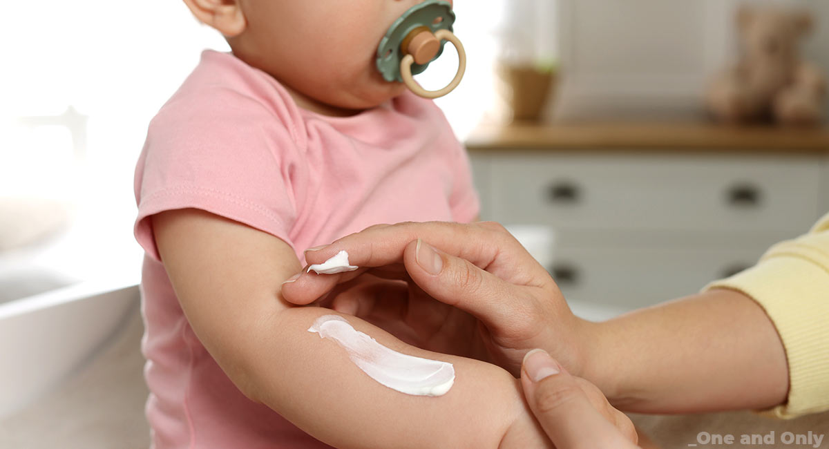 Mosquito Bite Treatment For Babies
