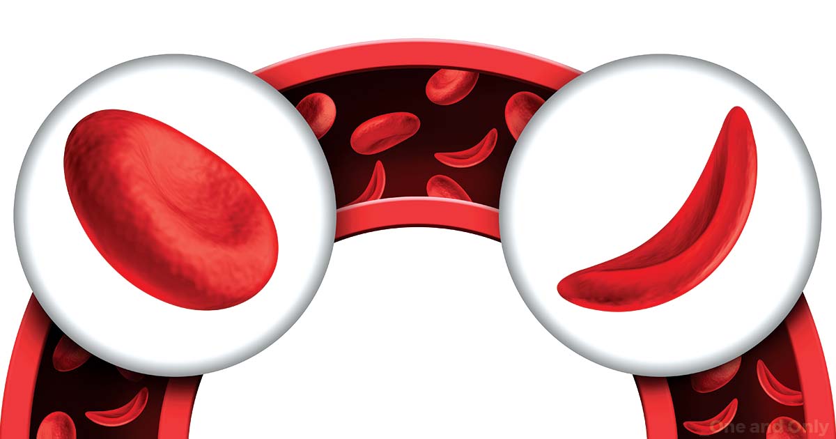 What are the Common Symptoms of Anemia?