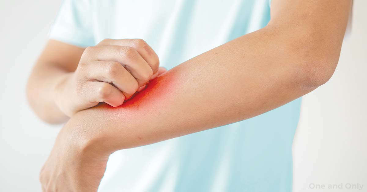 What are the Different Types of Eczema with their Causes and Symptoms?
